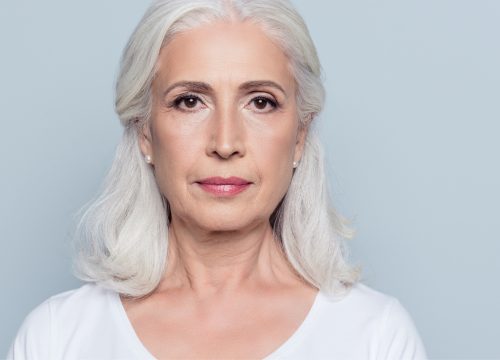 Eyes & Smile Wrinkles Treatment in Orlando, FL, & nearby areas  