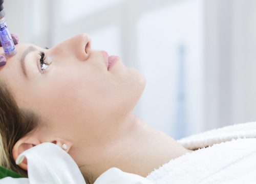 Microneedling Facial Treatment in Orlando, FL & Nearby Areas
